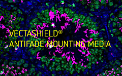 VECTASHIELD® Antifade Mounting Media: Schutz für Ihre Fluoreszenzproben